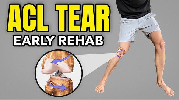 🦵 ACL Injury Recovery Plan – Step-by-Step Guide
👨...